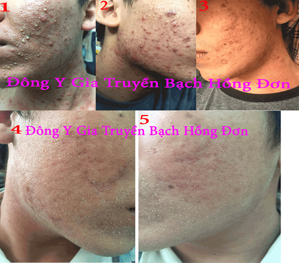 1476550962 My Pham Bach Hoa Hong 112