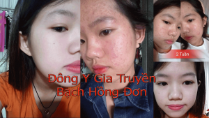 1500105583 Quynh Nhi