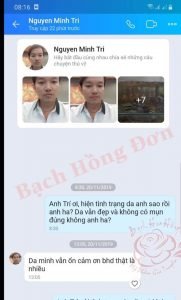 Khách trị mụn phản hồi hiệu quả tận gốc.
