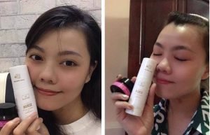 Diễm dùng Serum và kem đặc dưỡn Diễm dùng serum và kem đặc sau khiđiều trị hiệu quả mụn ẩn, mụn viêm, mụn đầu đen, thâm mụn, da sạm, lỗ chân lông to,...