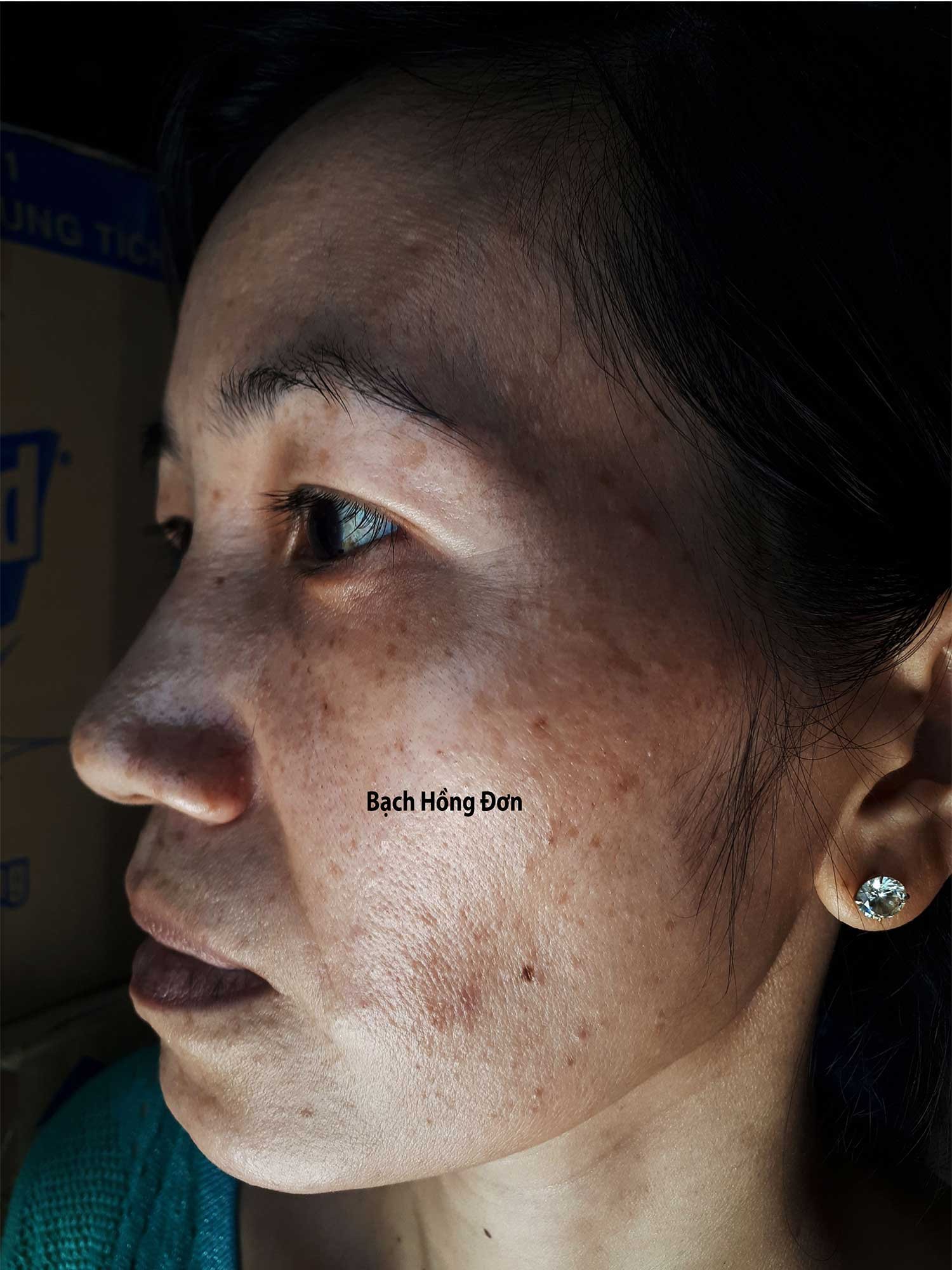 Bạch Hồng đơn Nguyễn Thị Thảo 1