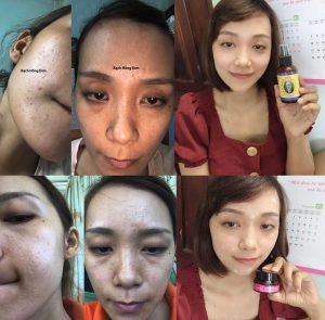 Bạch Hồng đơn Tú Uyên