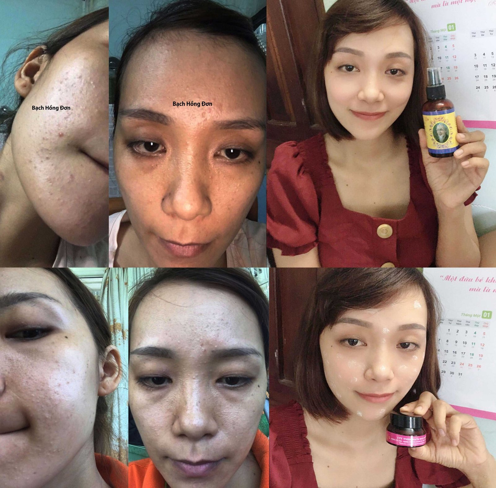 Bạch Hồng đơn Tú Uyên