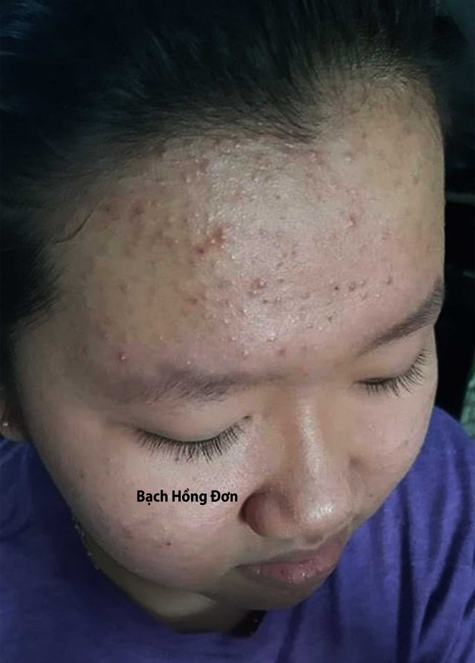 Bạch Hồng đơn Vũ Hạnh 111