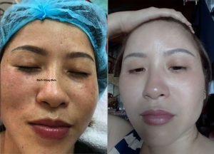 Mỹ Phẩm Bạch Hồng đơn Trần Ngọc Ok12ok