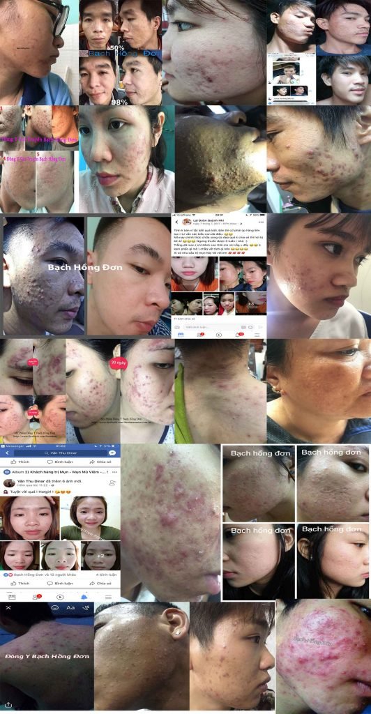 Khách Hàng Sử Dụng Hiệu Quả 1